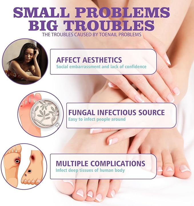 Nail Fungus Spray / رذاذ فطريات الأظافر