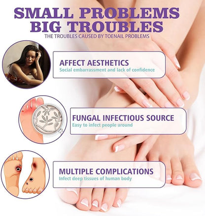 Nail Fungus Spray / رذاذ فطريات الأظافر