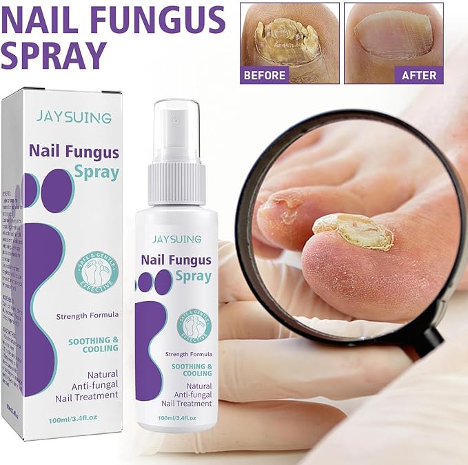 Nail Fungus Spray / رذاذ فطريات الأظافر