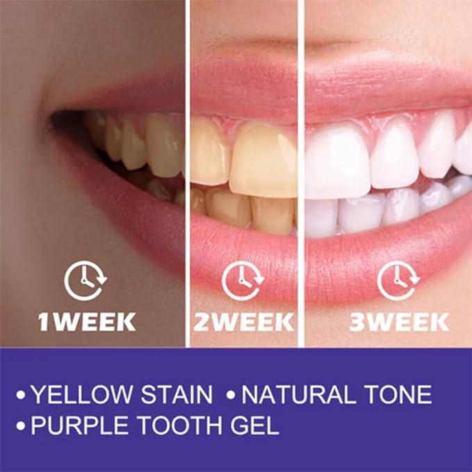 Purple Whitening Toothpaste™ ! ™معجون أسنان مبيض أرجواني